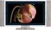 Get support for Sony PDM-4210 - Plasma Display Panel
